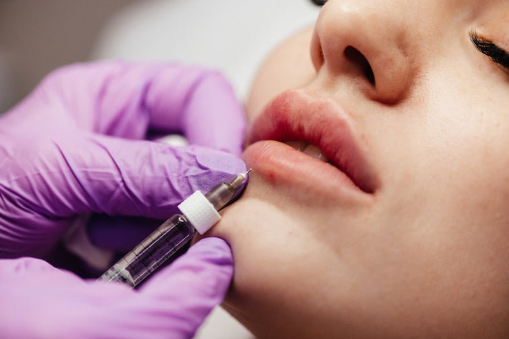 Top Lip Treatments & Cosmetic Procedures for a Perfect Pout