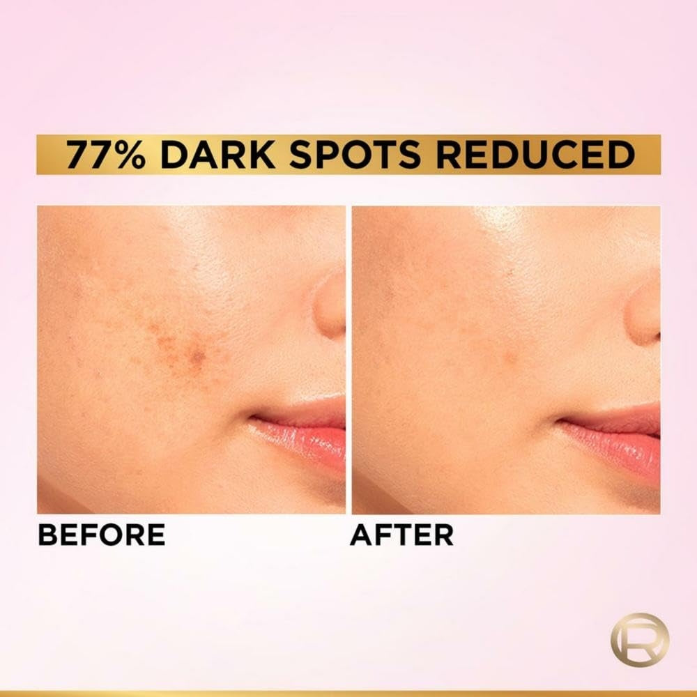 L'Oreal Paris Glycolic Bright Face Serum for Brightening Dark Spots 30ml