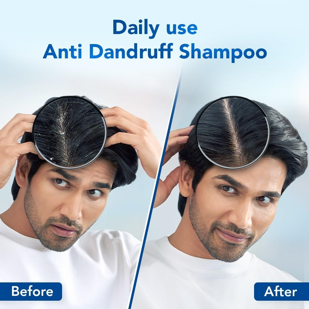 Scalpe Pro Daily Anti-Dandruff Shampoo|Removes Dandruff| Helps With Itching, Irritation & Redness|Climbazole & Zpto Formulation|Strong & Smooth Hair| Daily Use|Dermatologically Tested|For Unisex|200Ml
