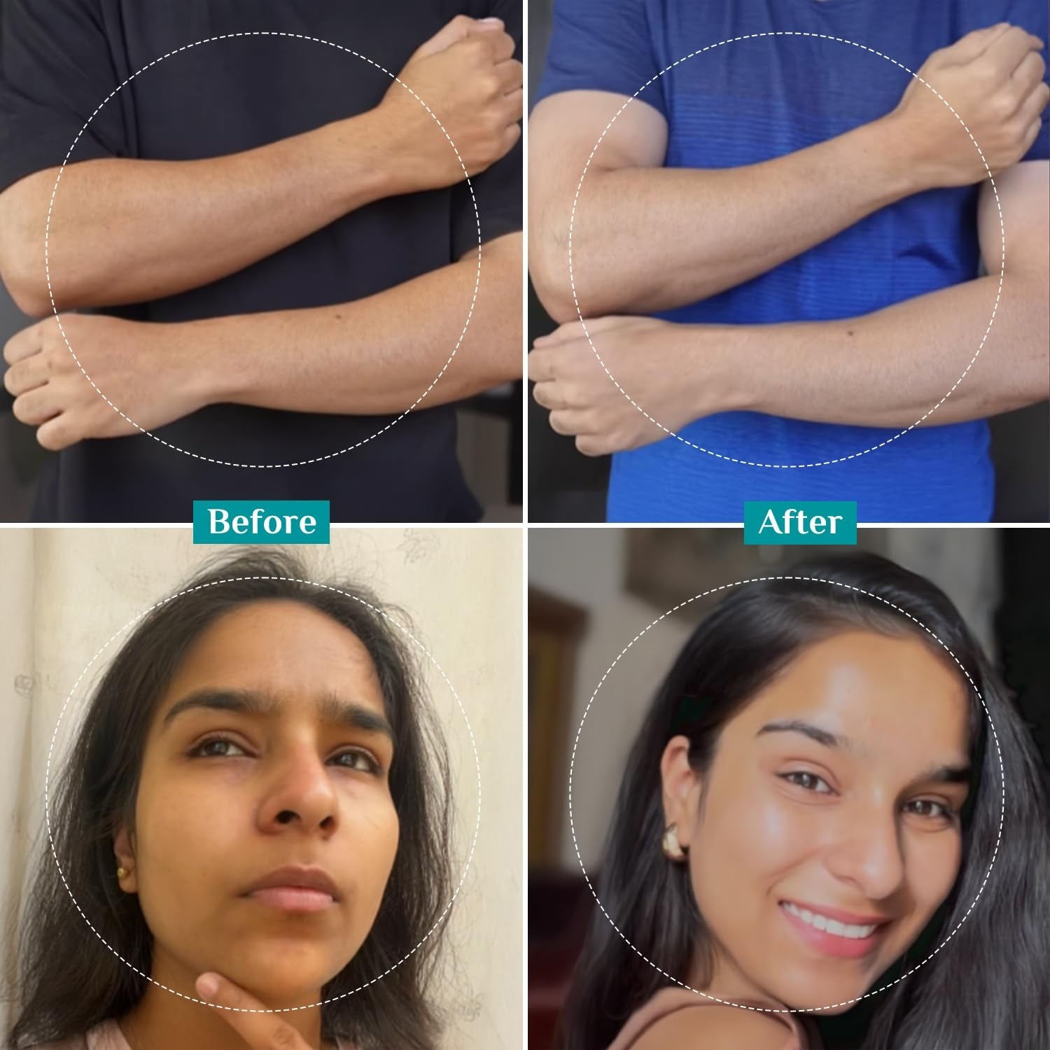 Pilgrim 25% AHA + 2% BHA + 5% PHA Peeling Solution | Men, Women